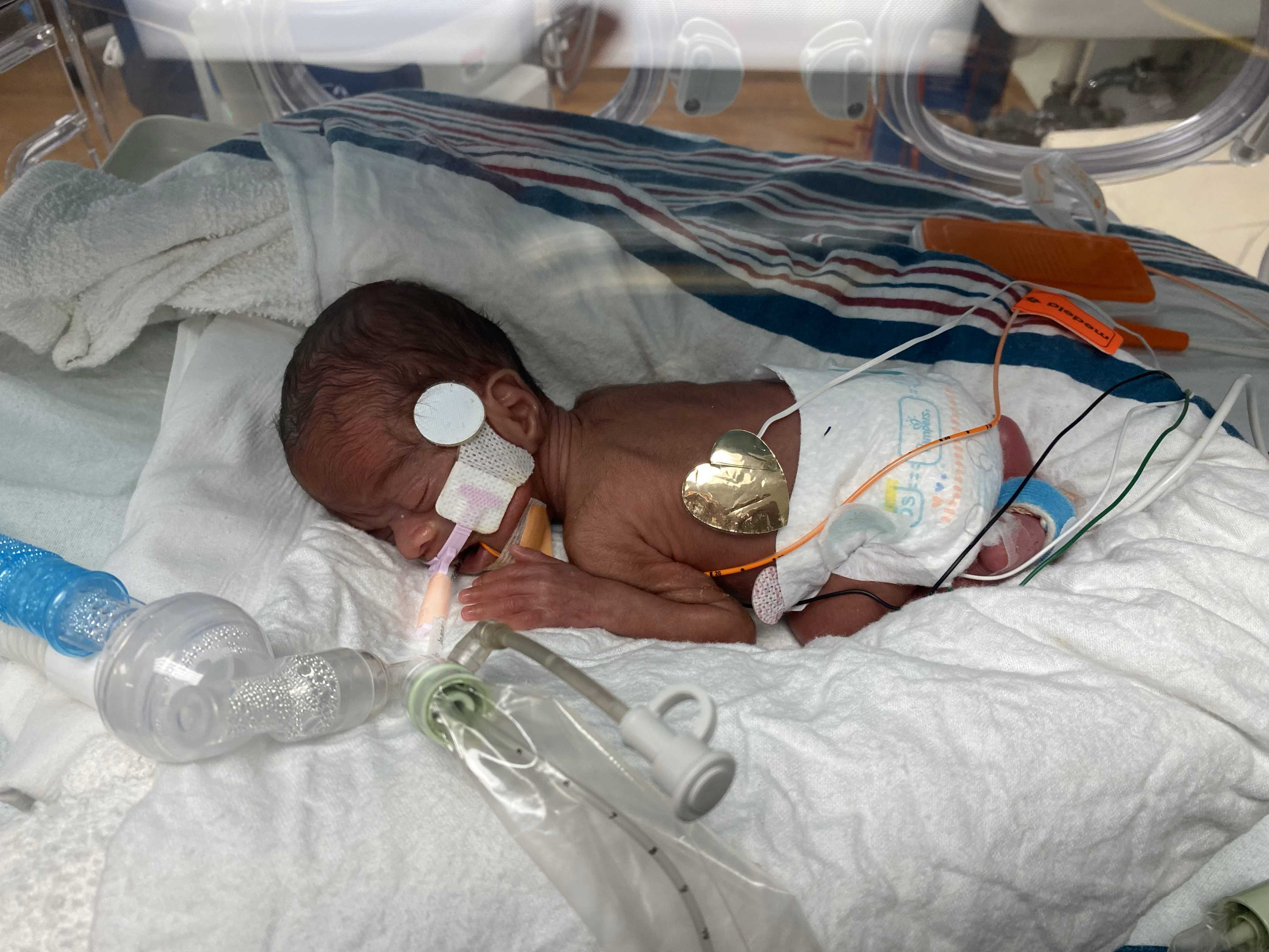 Mom credits willpower, specialized medical device with saving son’s life