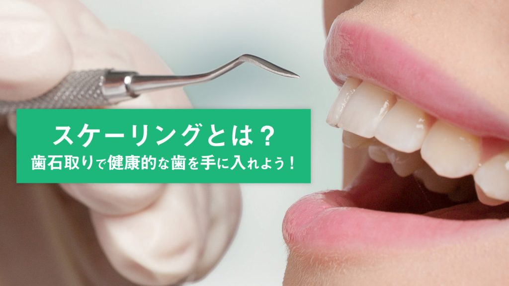 スケーリングとは？歯石取りで健康的な歯を手に入れよう！