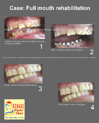 Best Dental Clinic in Lalitpur Cosmetic Dentistry Dental Clinic