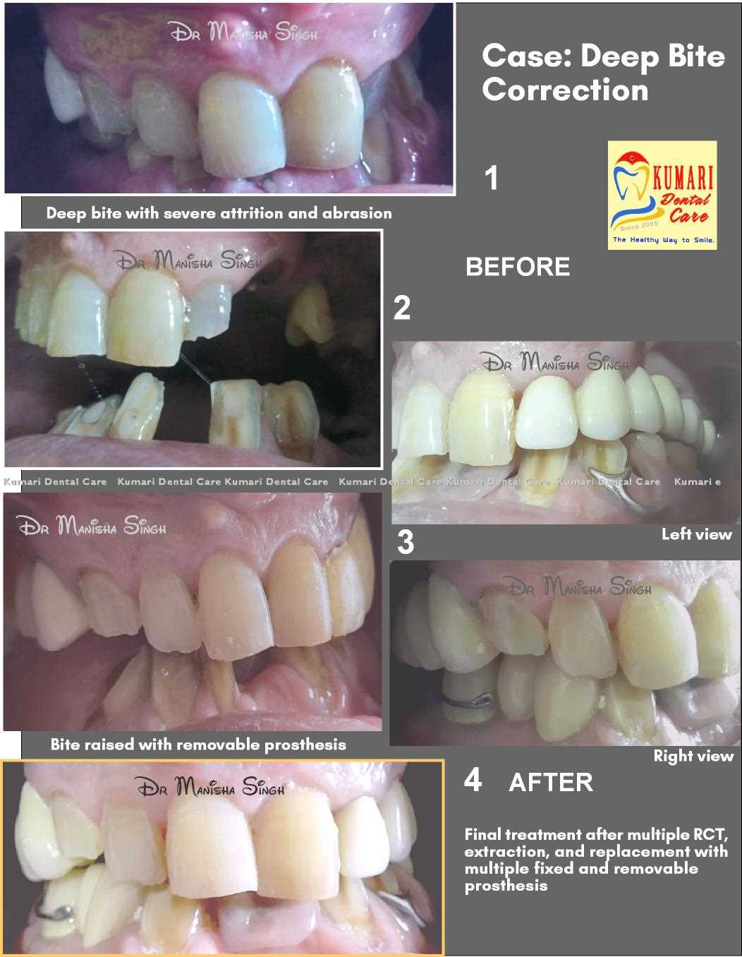 Best Dental Clinic in Lalitpur Cosmetic Dentistry Dental Clinic