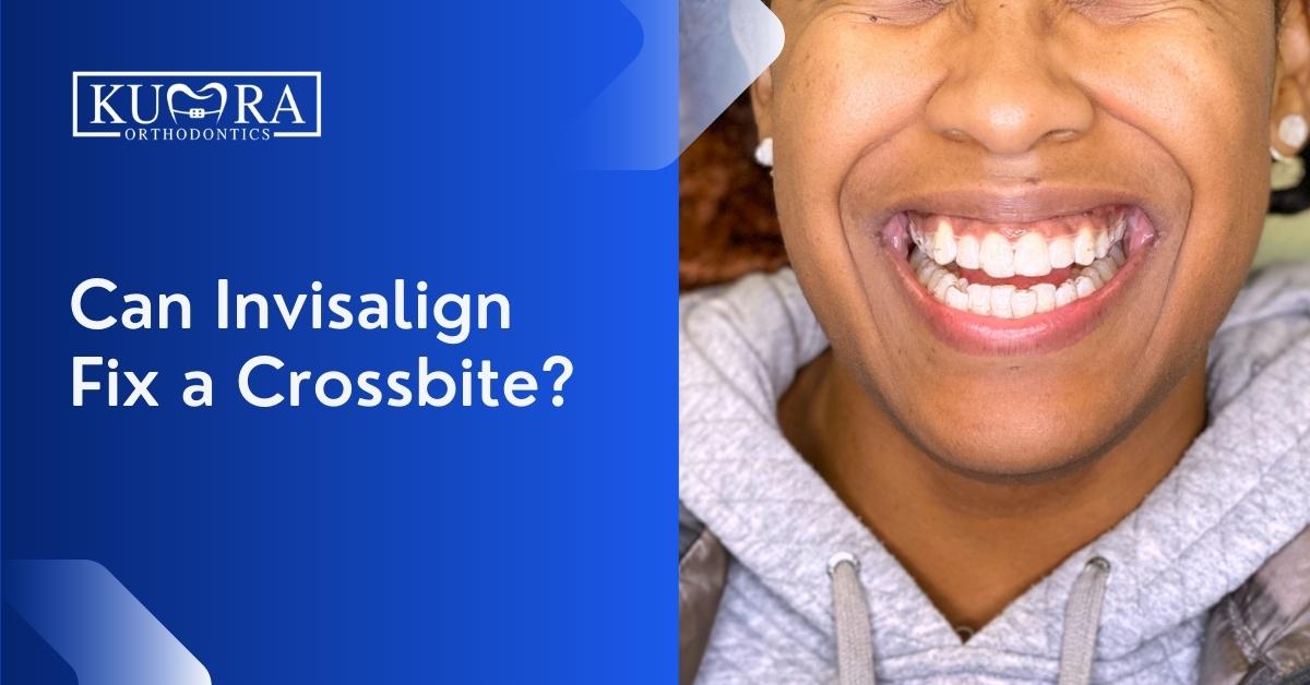 Can Invisalign Fix a Crossbite? Kumra Orthodontics