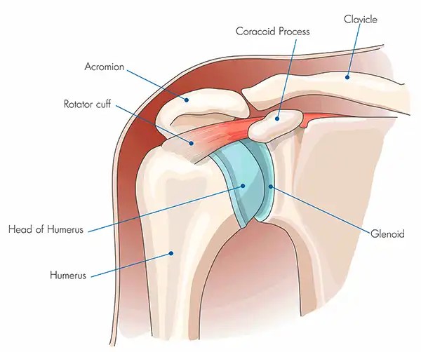 Bicep Pain After Rotator Cuff Surgery 6 Critical Causes