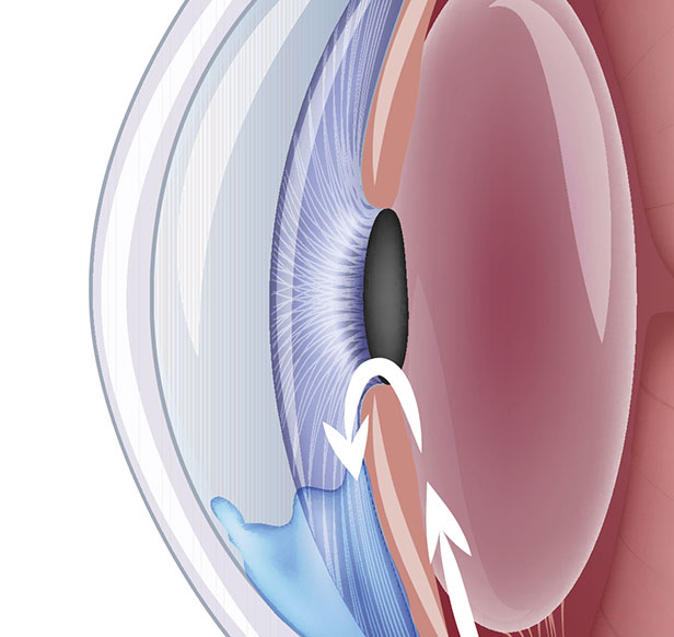 Medical Services Kentucky Eye Center