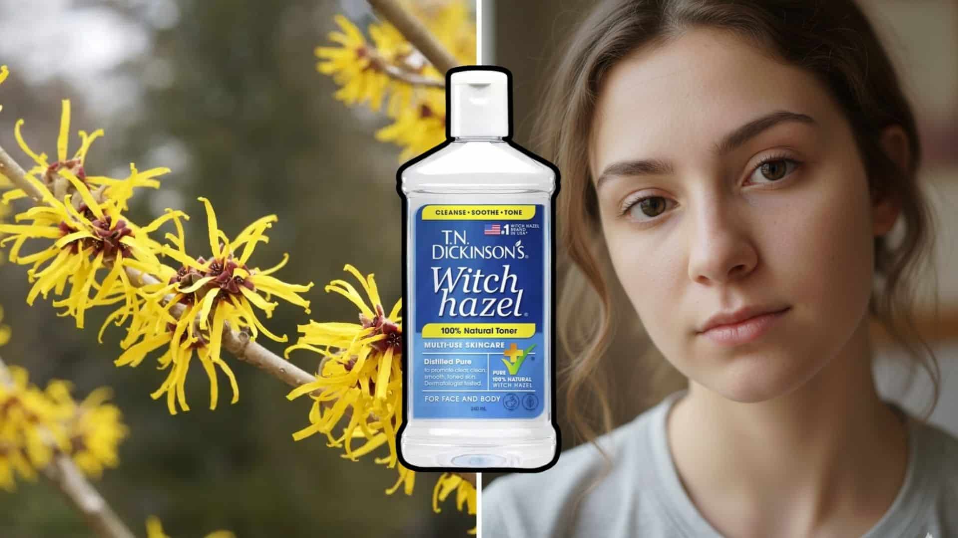 7 Benefits of Applying Witch Hazel to Your Face LA Story