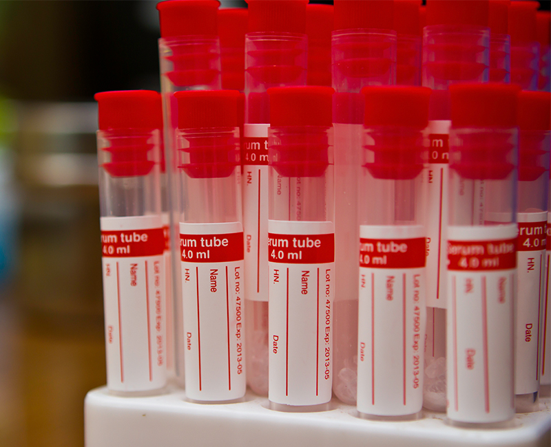 OUR SERVICES Medical Healthcare Laboratory in Johor Bahru