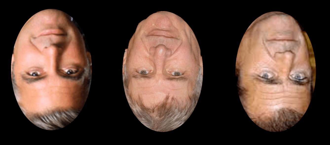 Prosopagnosia in Childhood