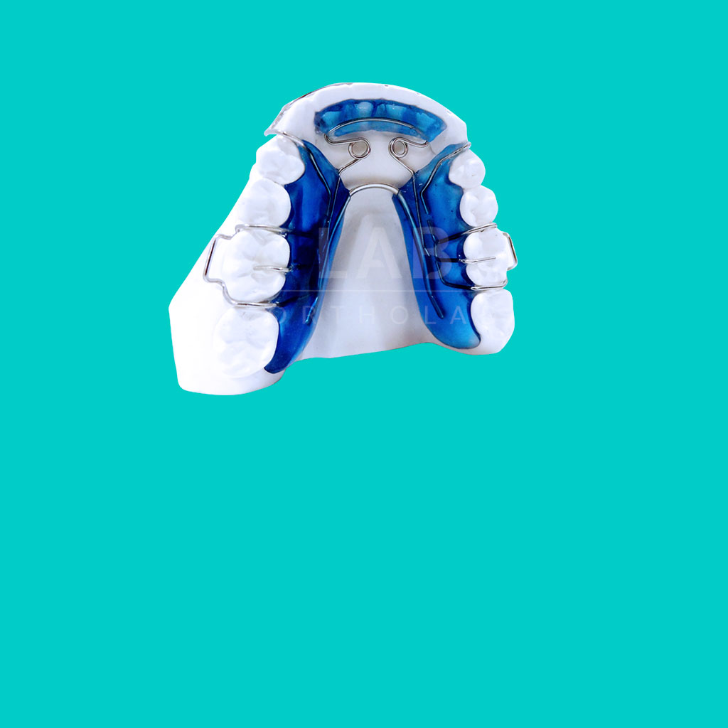 Spring Retainer Placas Activas Ortodoncia Lab by OrthoLab