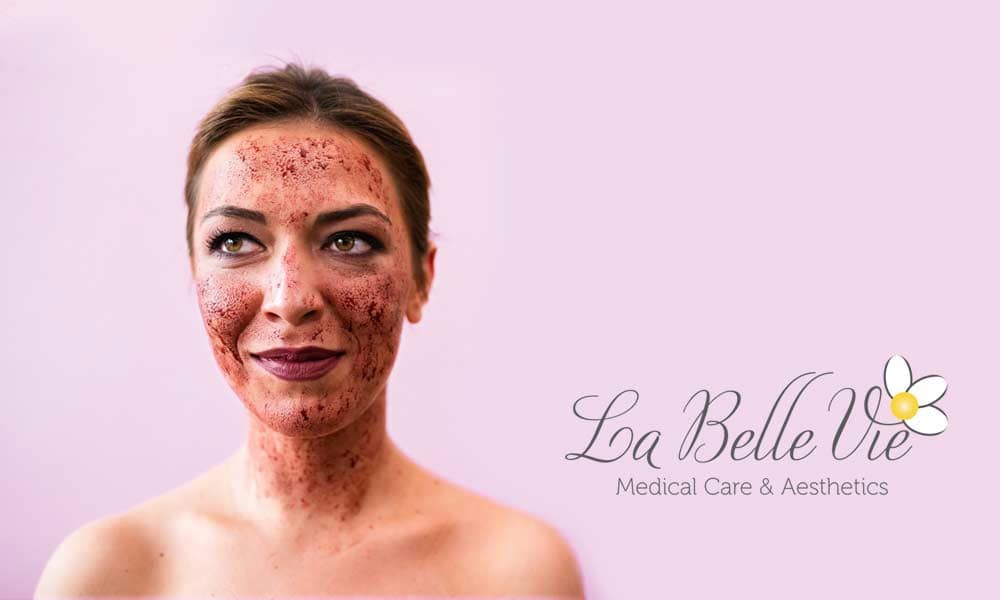 Vampire Facial Near Me Utah Vampire Facelift