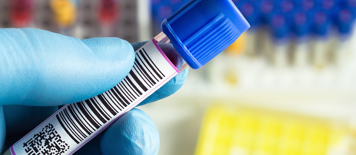 PressureSensitive Labels, Barcode Printing, Flexographic Label