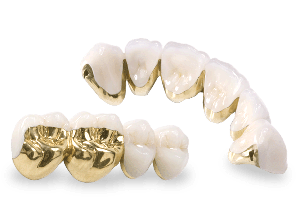PFM HIGH NOBLE (GOLD ALLOY) Lavina