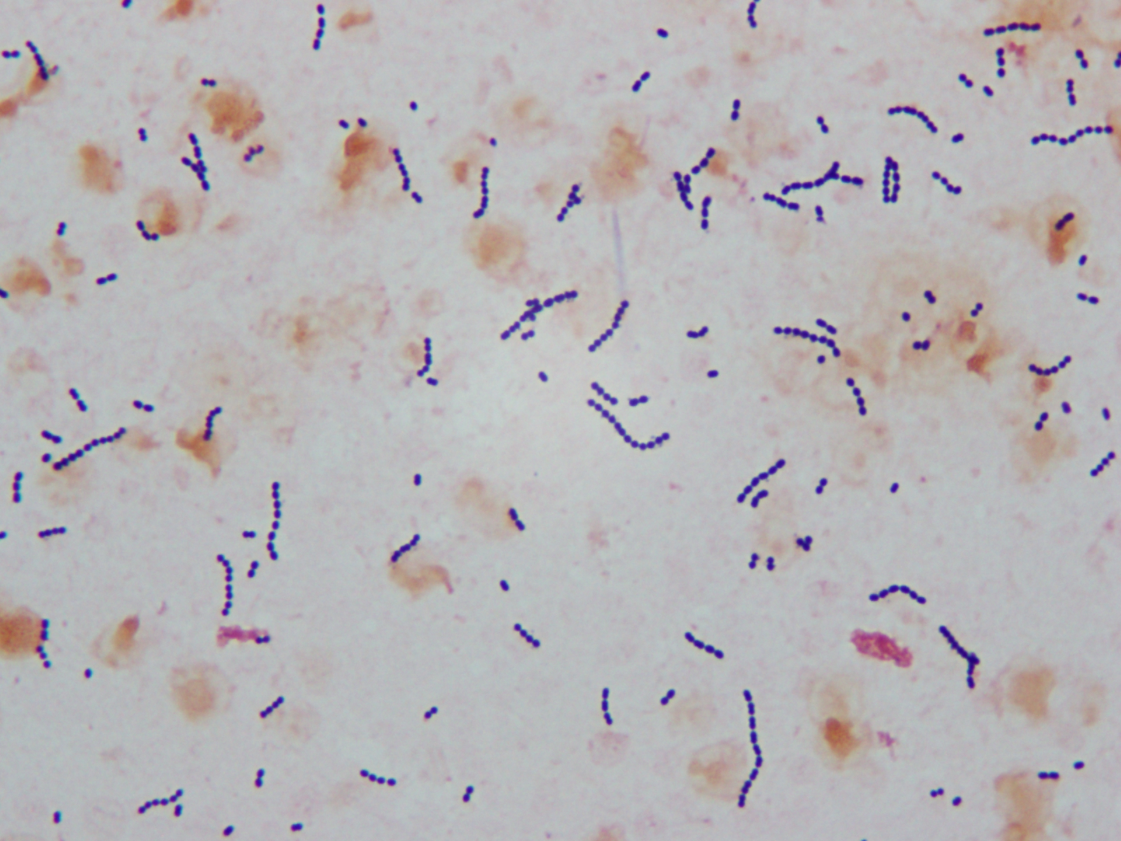 Microbiology Case Study an 11 Month Old with a 3 Day History of