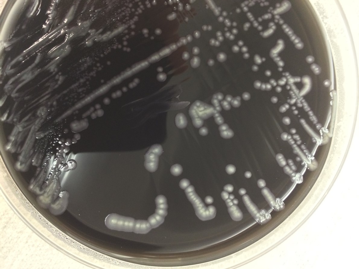 Legionella Lablogatory
