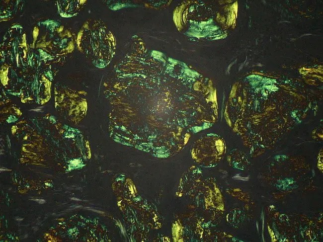 Alkaline Congo Red Staining Technique for Amyloid Principle