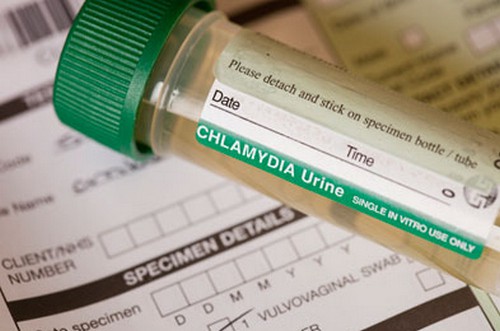 Chlamydia Test (How to test for chlamydia at home kit