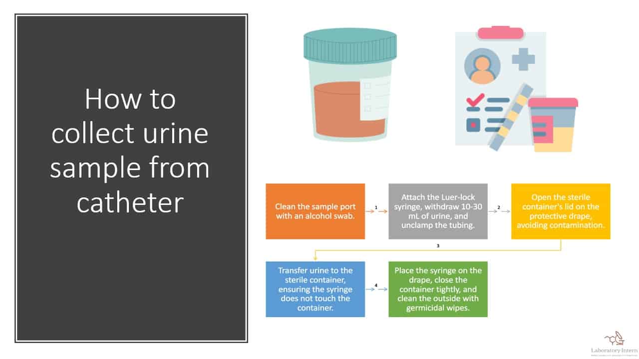 How to collect urine sample from catheter 2024 Update