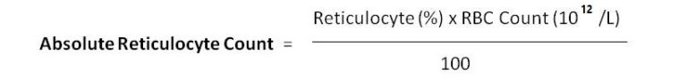 Reticulocyte Count Principle, Procedure, Calculations and Clinical