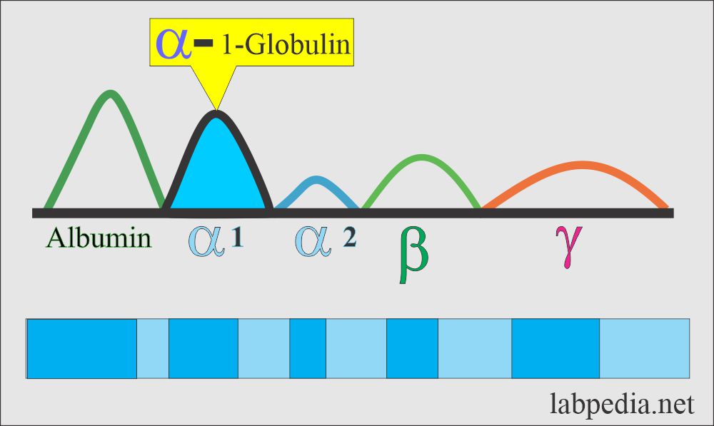 Serum Protein Electrophoresis Procedure, Total protein, albumin and