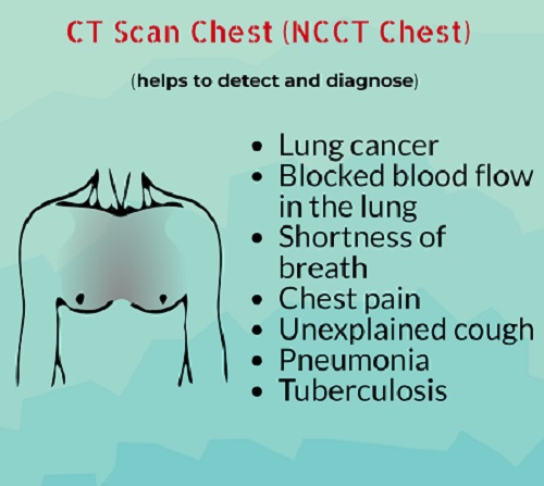 60% Off On Ct Scan Chest Cost In Noida: ₹1800 Only - Book Now! | Mfine