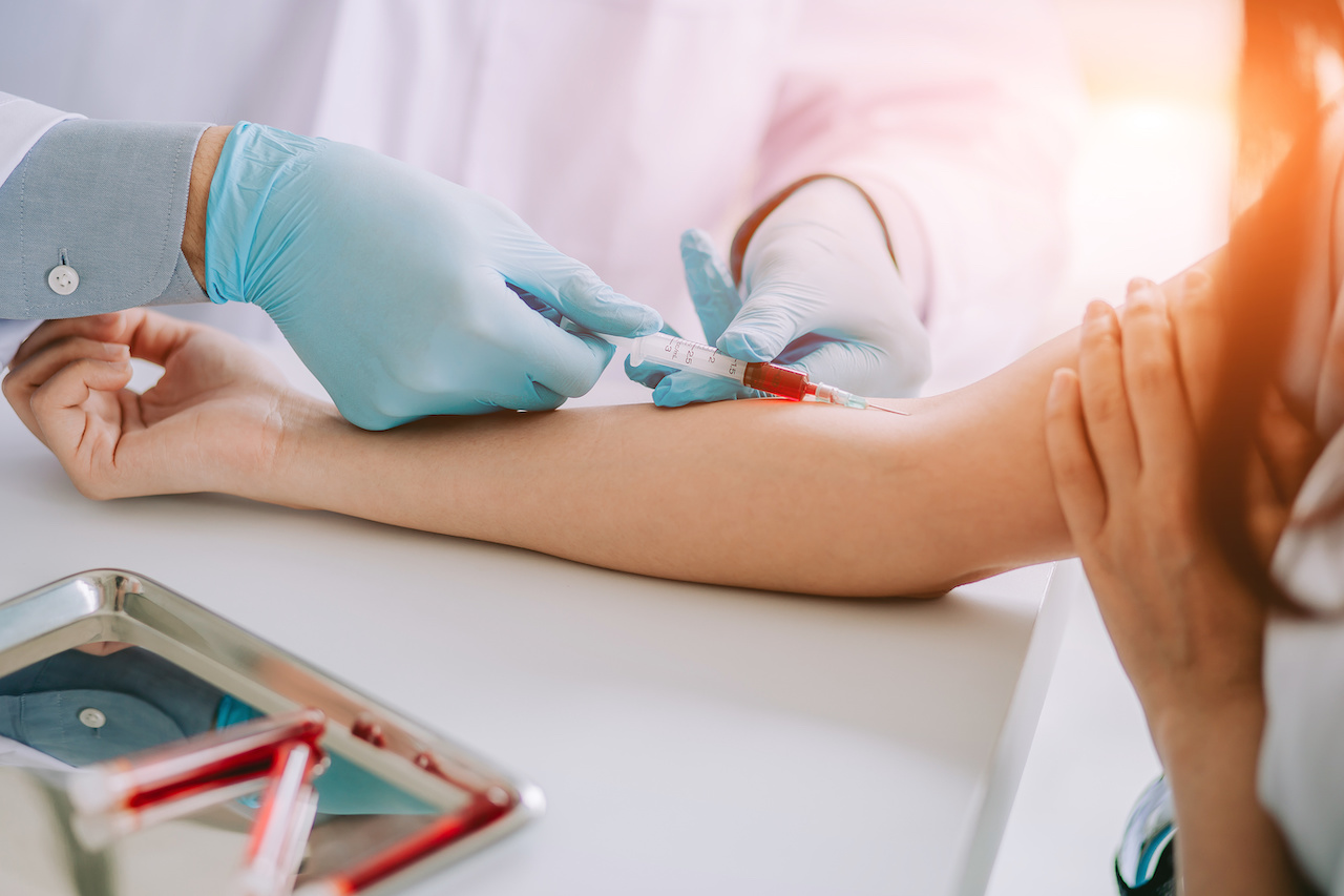 What is Carbon Dioxide (CO2)? Blood Tests & Normal Levels SelfDecode Labs