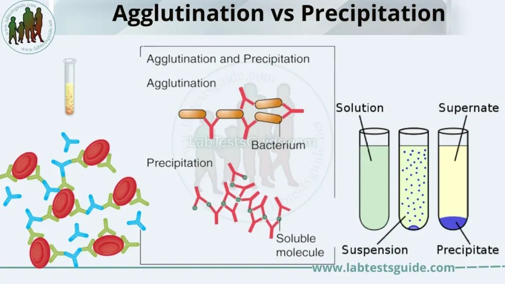 Agglutination vs Precipitation Lab Tests Guide