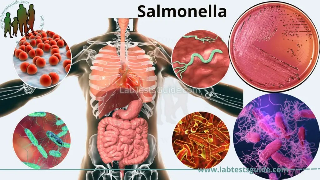 Salmonella Symptoms, Treatment, and Prevention A Comprehensive Guide