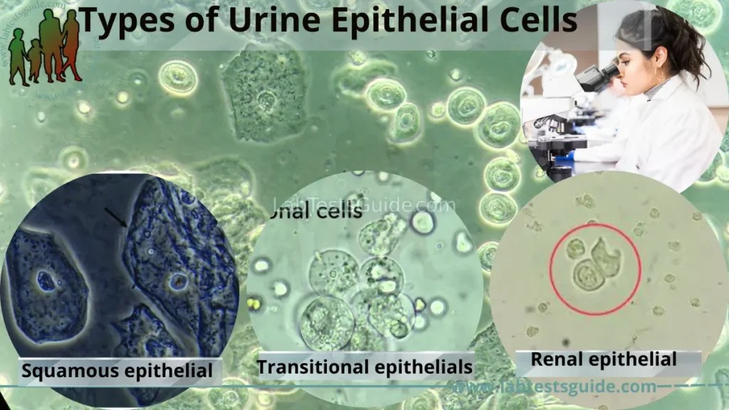 Causes Of High Epithelial Cells In Urine Microscopic, 48 OFF