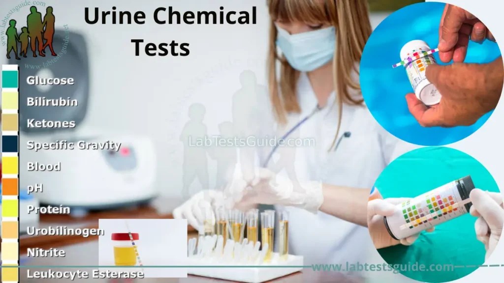 Urine Chemical Tests Purpose, Types, Preparation, Procedure, and