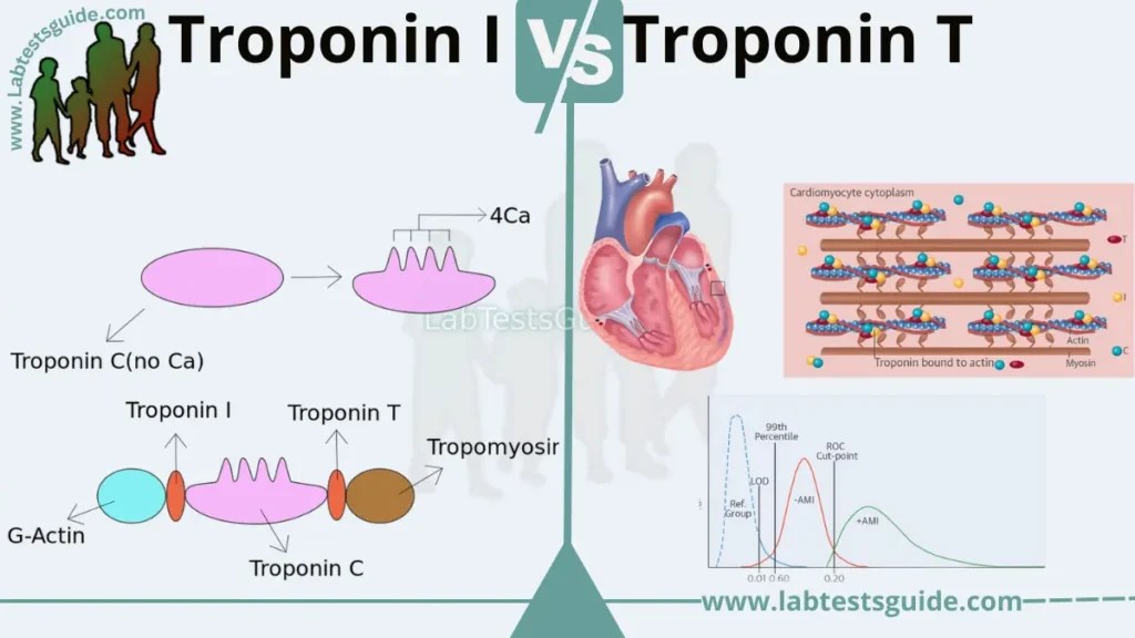 Difference Between Troponin I and Troponin T Lab Tests Guide