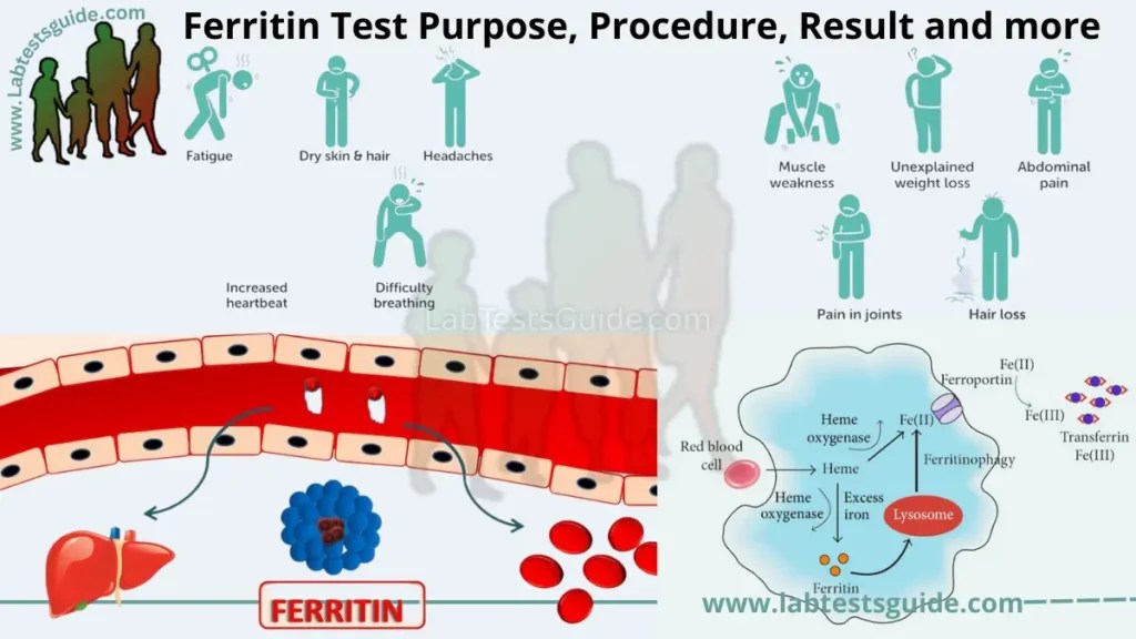 Ferritin Test Purpose, Procedure, Result and more LTG