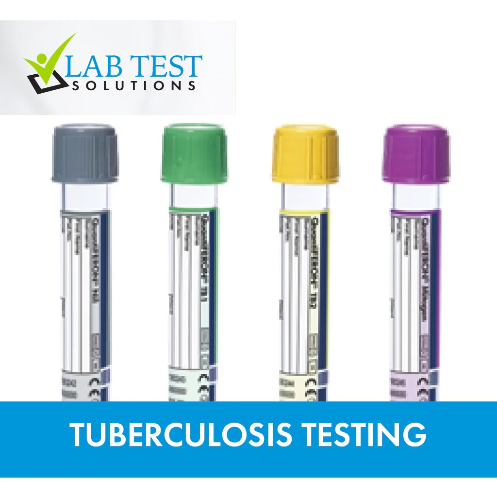 QuantiFERON®TB Gold Plus The Gold Standard in Tuberculosis Testing