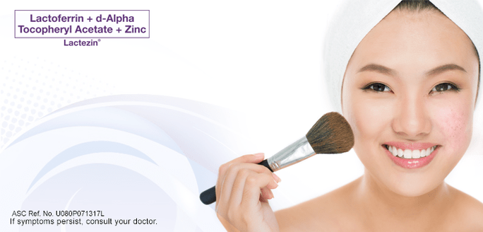 Pimple Care Tips Your Cheat Sheet to Fighting Whiteheads Lactezin