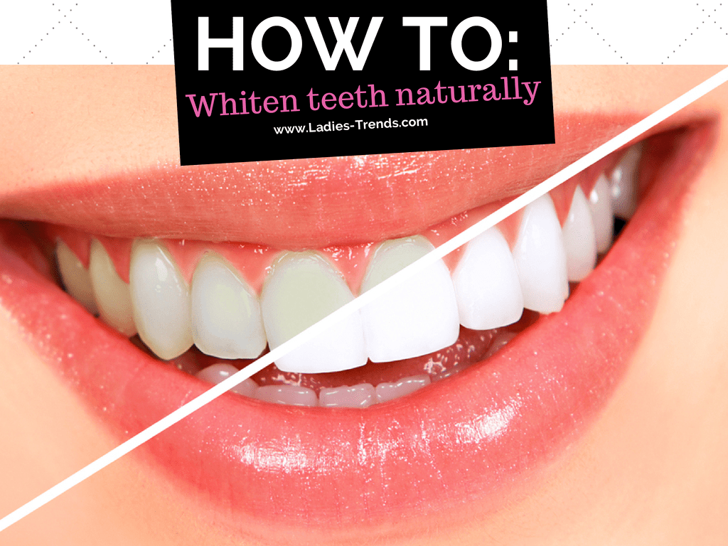 How to whiten your teeth naturally