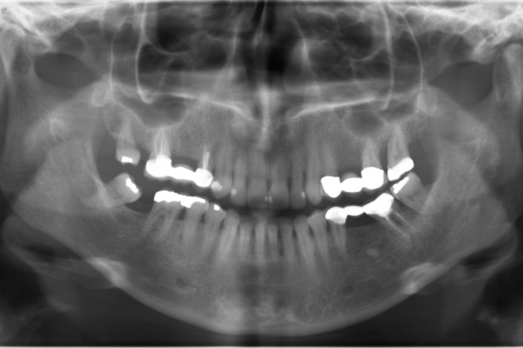 Dental Diagnostic Imaging Center Affordable Radiographs, 3D Dental