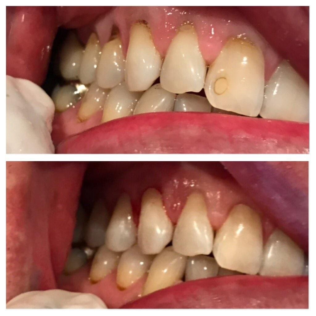 Smile Gallery Lakeland Dental