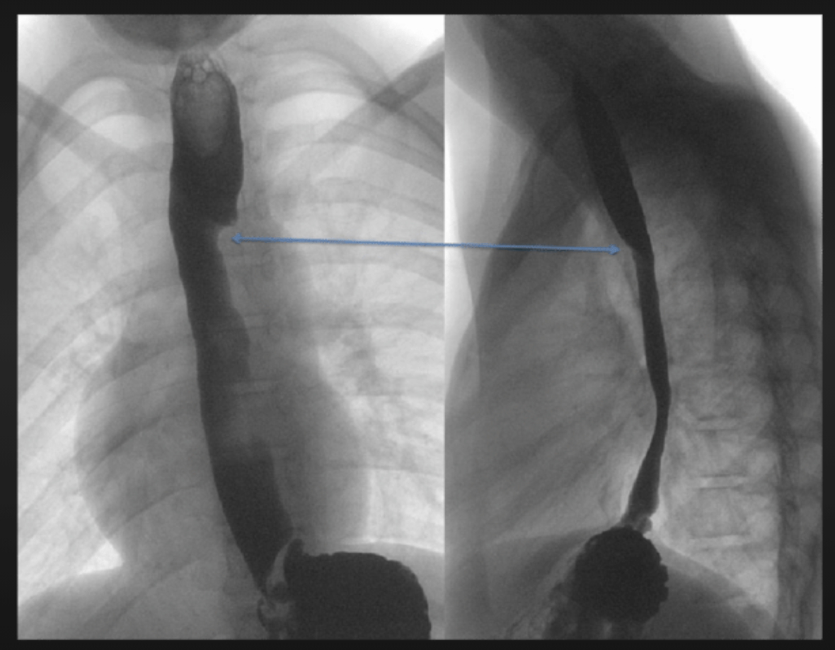 Fluoroscopy Lakes Radiology