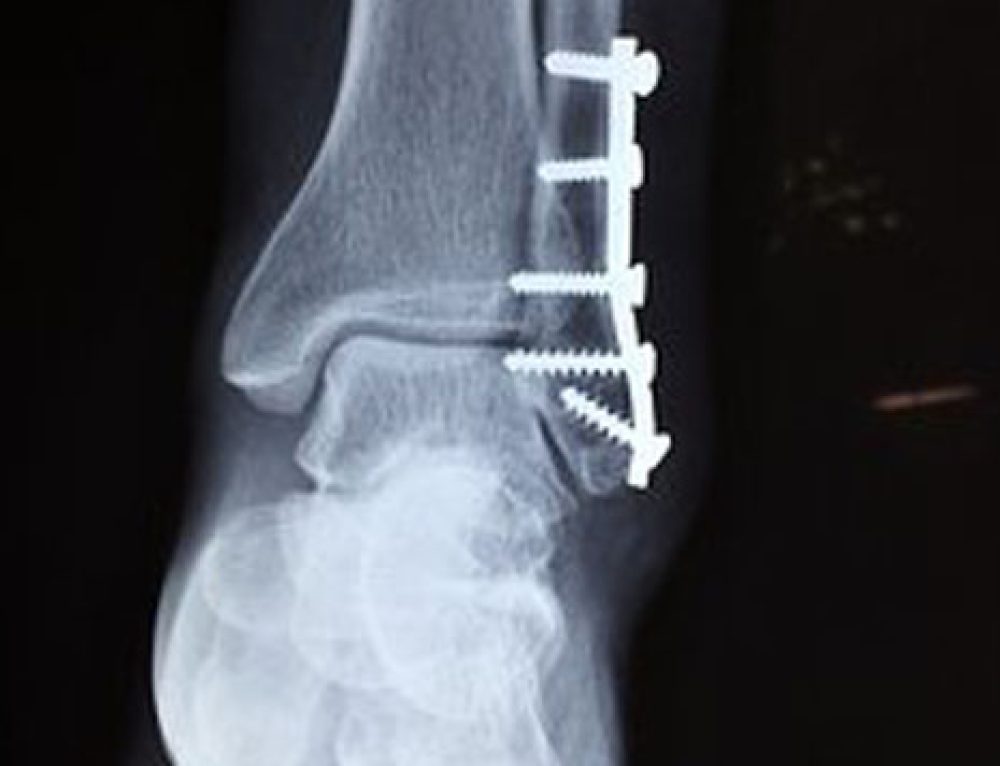 NO CONTACT ORDER VIOLATION BY VICTIM Lakin Afolabi Law