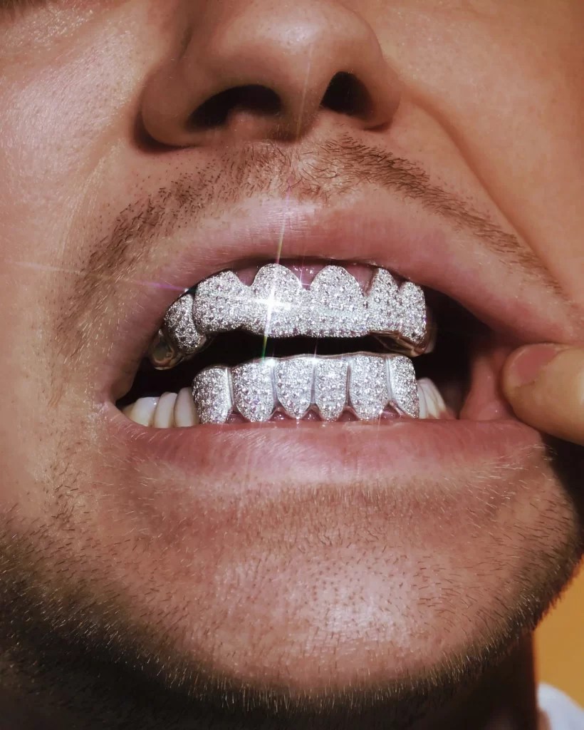 Grillz and 8 things you should know Nha Khoa Bedental