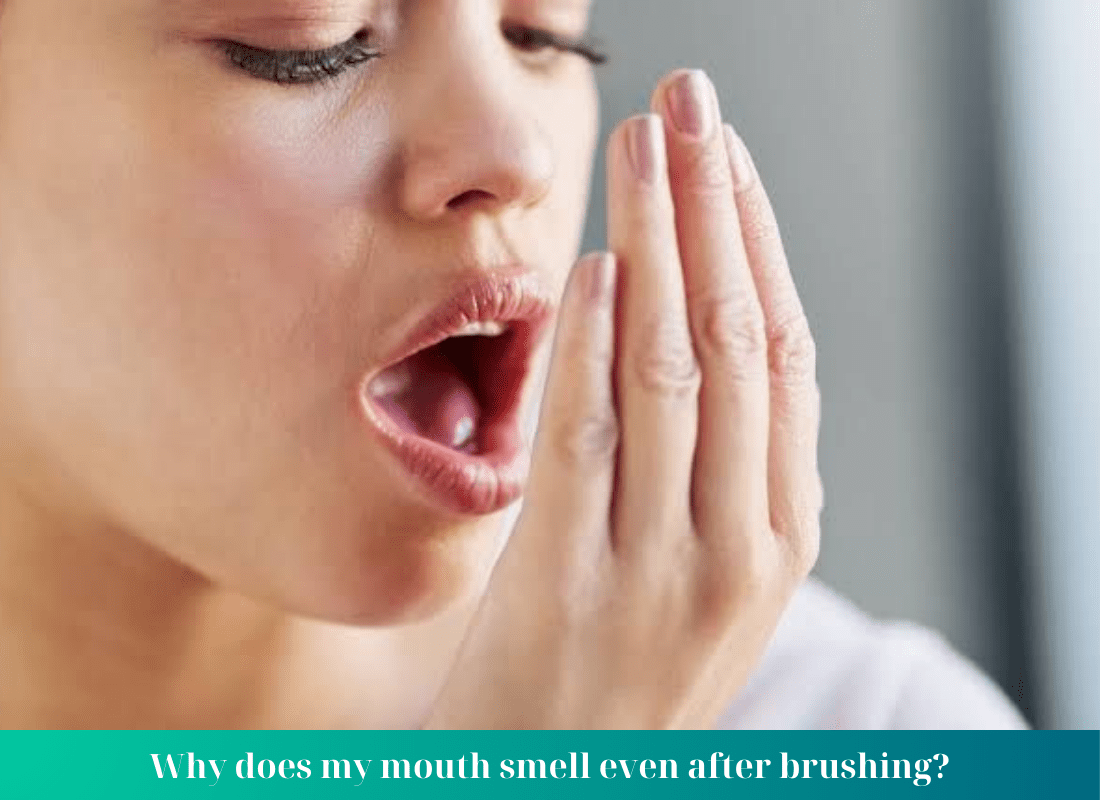 Bad Breath and 6 common questions Nha Khoa Bedental