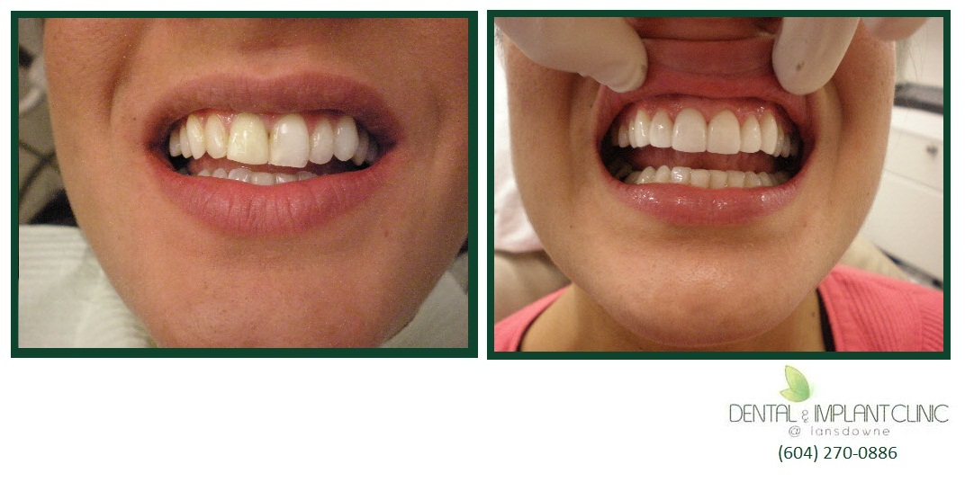 Gallery Dental & Implant Clinic Lansdowne