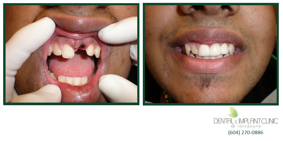 Gallery Dental & Implant Clinic Lansdowne