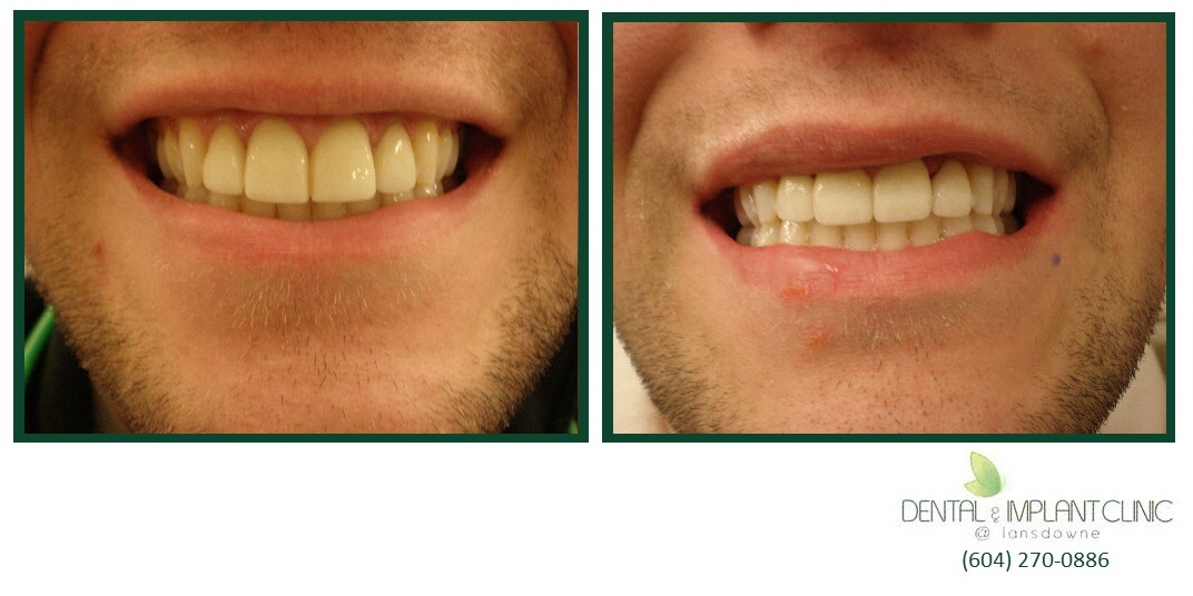 Gallery Dental & Implant Clinic Lansdowne