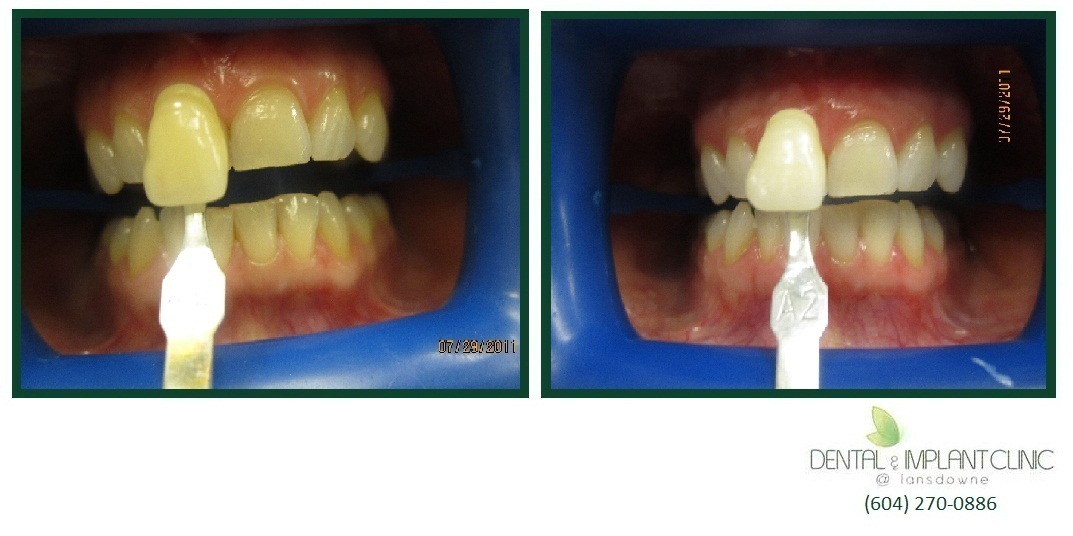 Gallery Dental & Implant Clinic Lansdowne