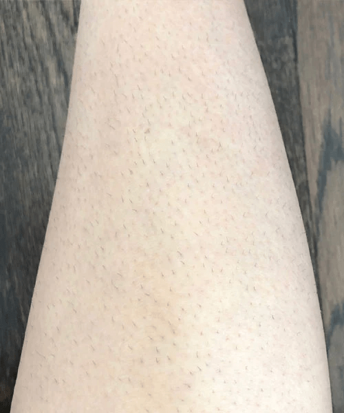 Lanveza™ IPL Laser Hair Removal Handset Lanveza Official site