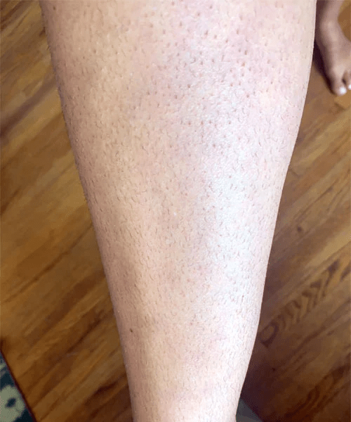 Lanveza™ IPL Laser Hair Removal Handset Lanveza Official site