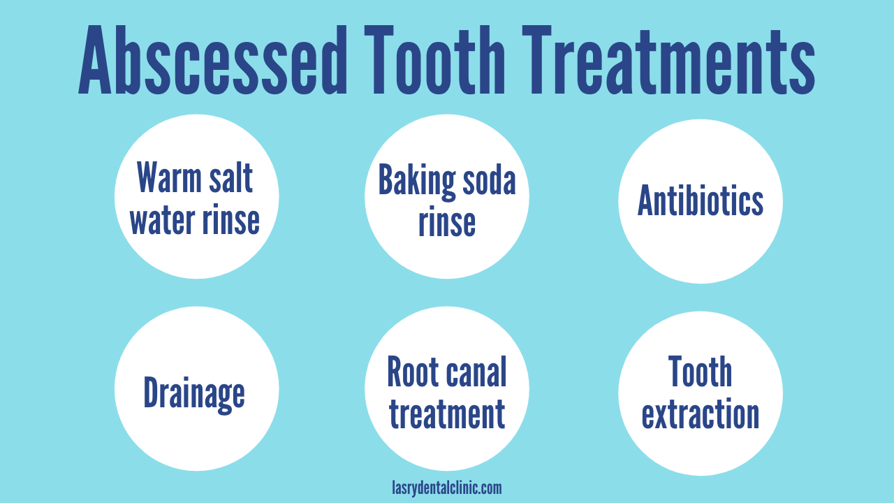 Abscessed Tooth Cause, Treatment, and AtHome Remedies