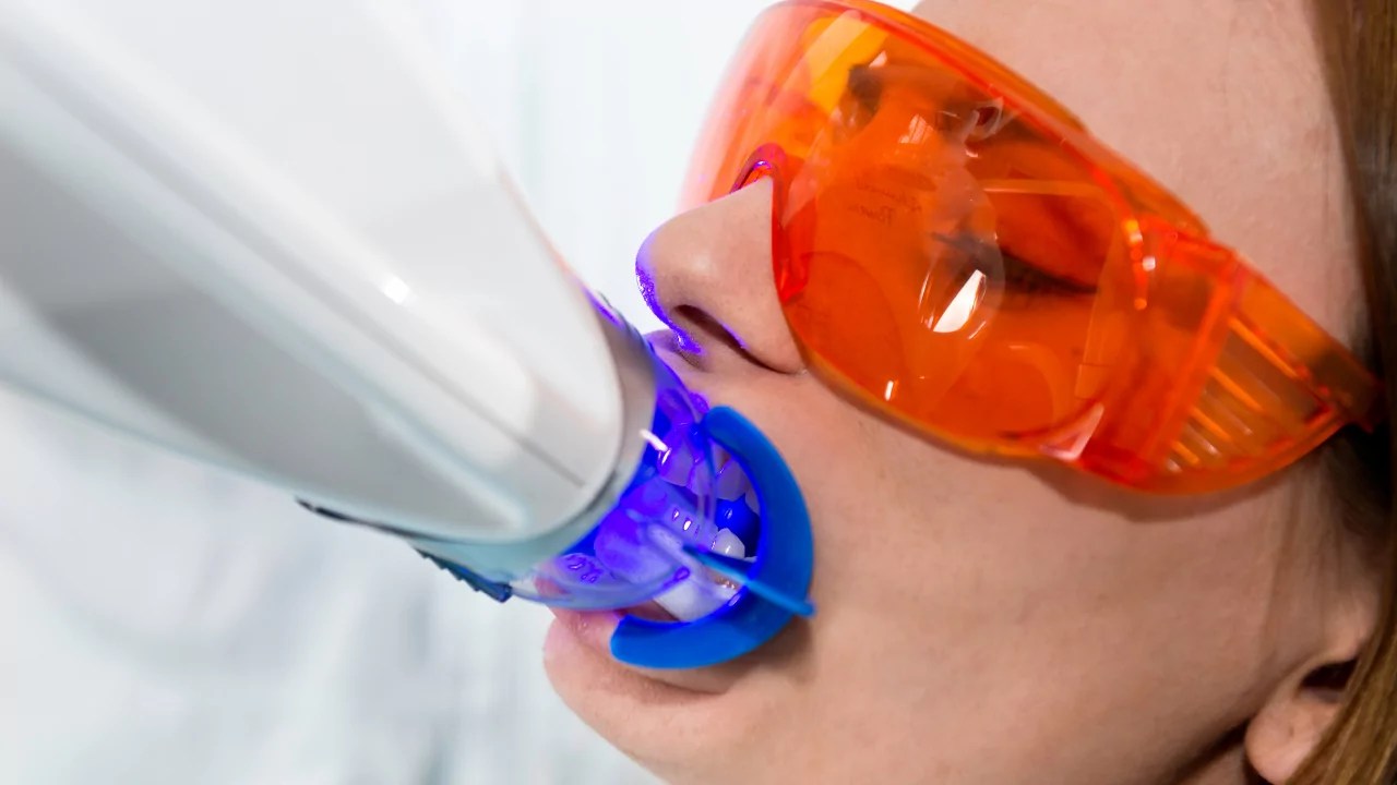 The Zoom Teeth Whitening Experience Cost, Procedure, and Pain