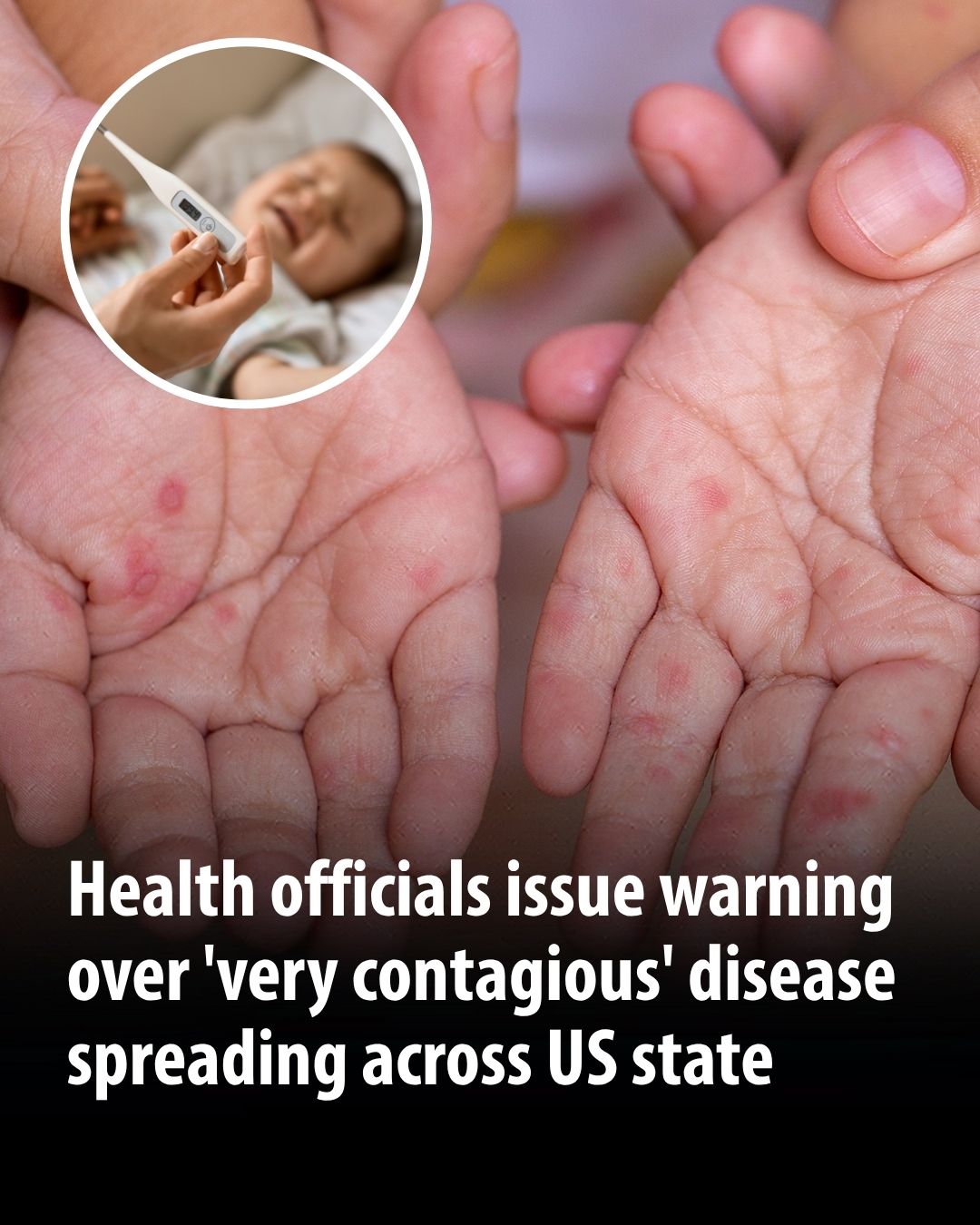 Health officials issue warning over 'very contagious' disease spreading