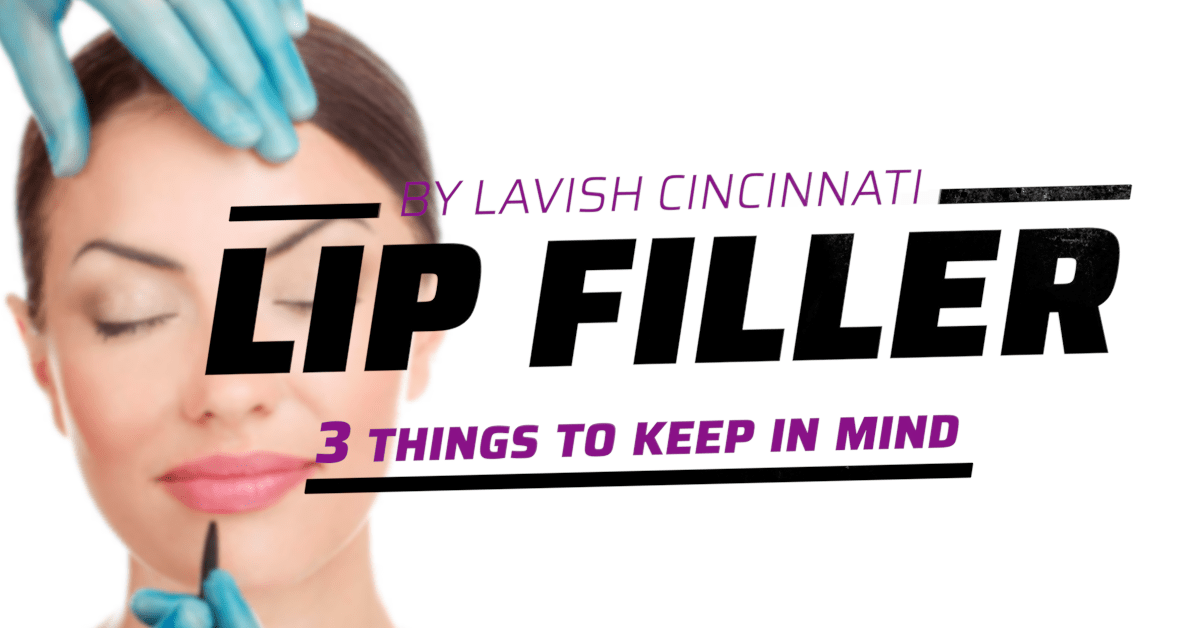 Lip Filler 3 Things To Consider Before Getting l Lavish Cincinnati