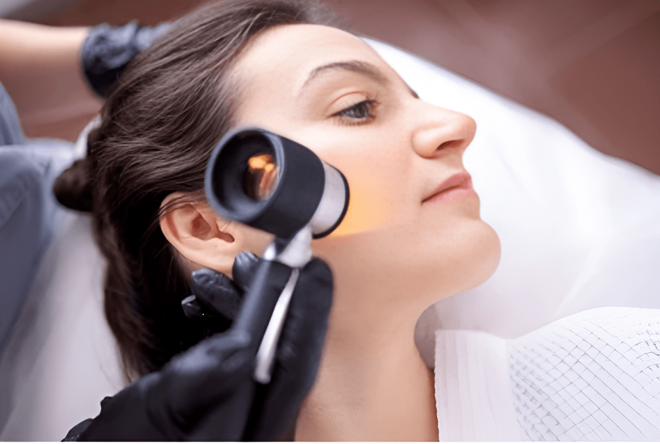 Miami's Acne Scar Experts Effective Treatments at Lavish Laser Medical