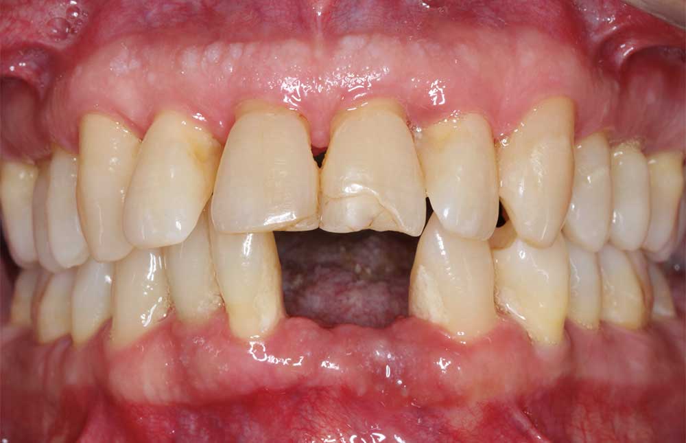 Nonsurgical Treatment Options Lawrence Perio